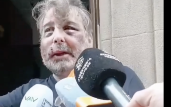 Valentín, vecino agredido en el barrio de A magdalena
