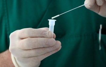 covid test antigenos sanidad coronavirus