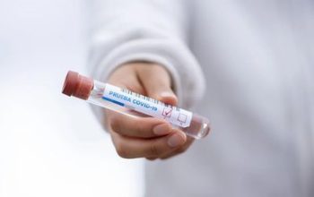 test saliva covid